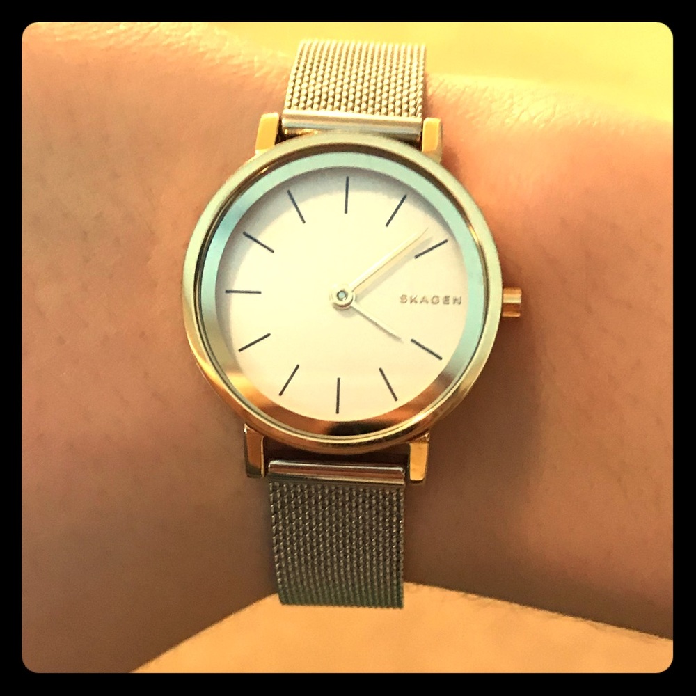 Women’s Skagen watch!